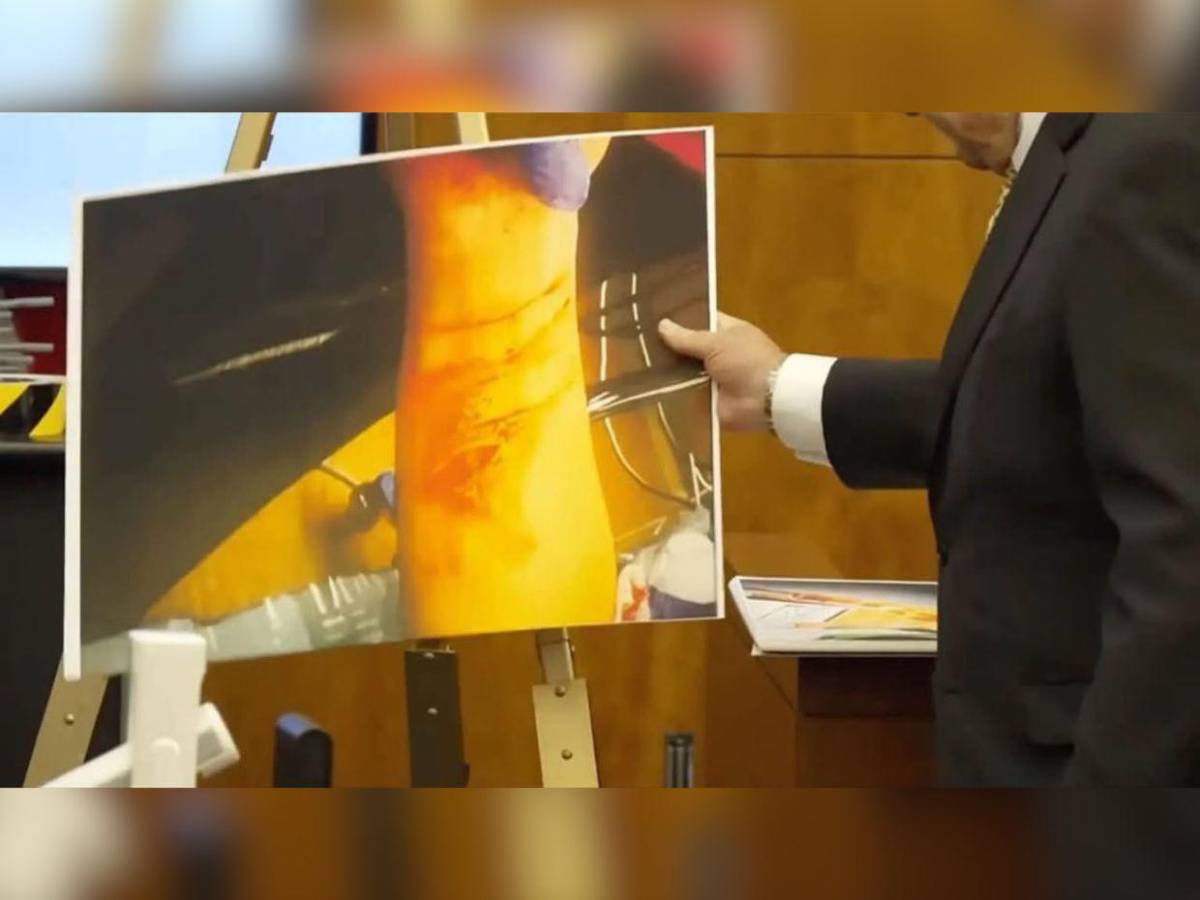 Lindsay Clancy rompe en llanto durante juicio al escuchar cómo intentaron salvar a su bebé