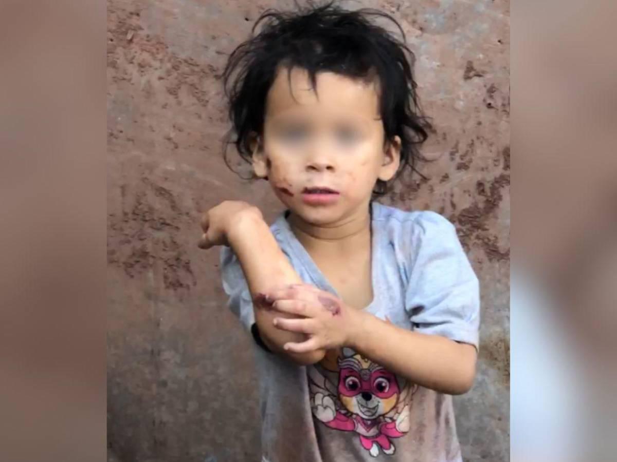 Adolescente que golpeaba a sus hijas en la capital vivía con hombre 59 años mayor