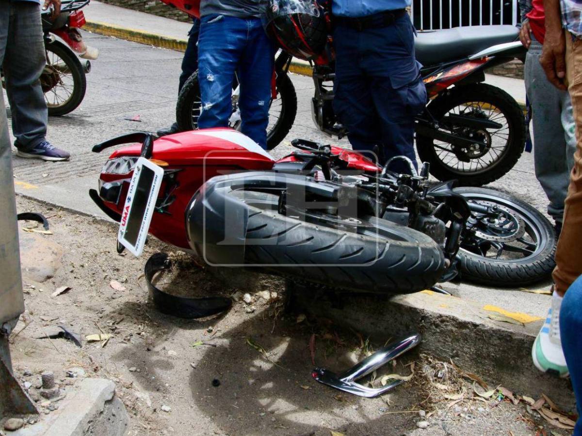Por evitar atropellar una persona: motociclista queda muy herido en accidente en Tegucigalpa