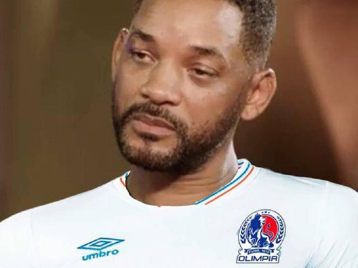 Los mejores memes tras la derrota del Olimpia ante América en Concacaf: Bengtson señalado