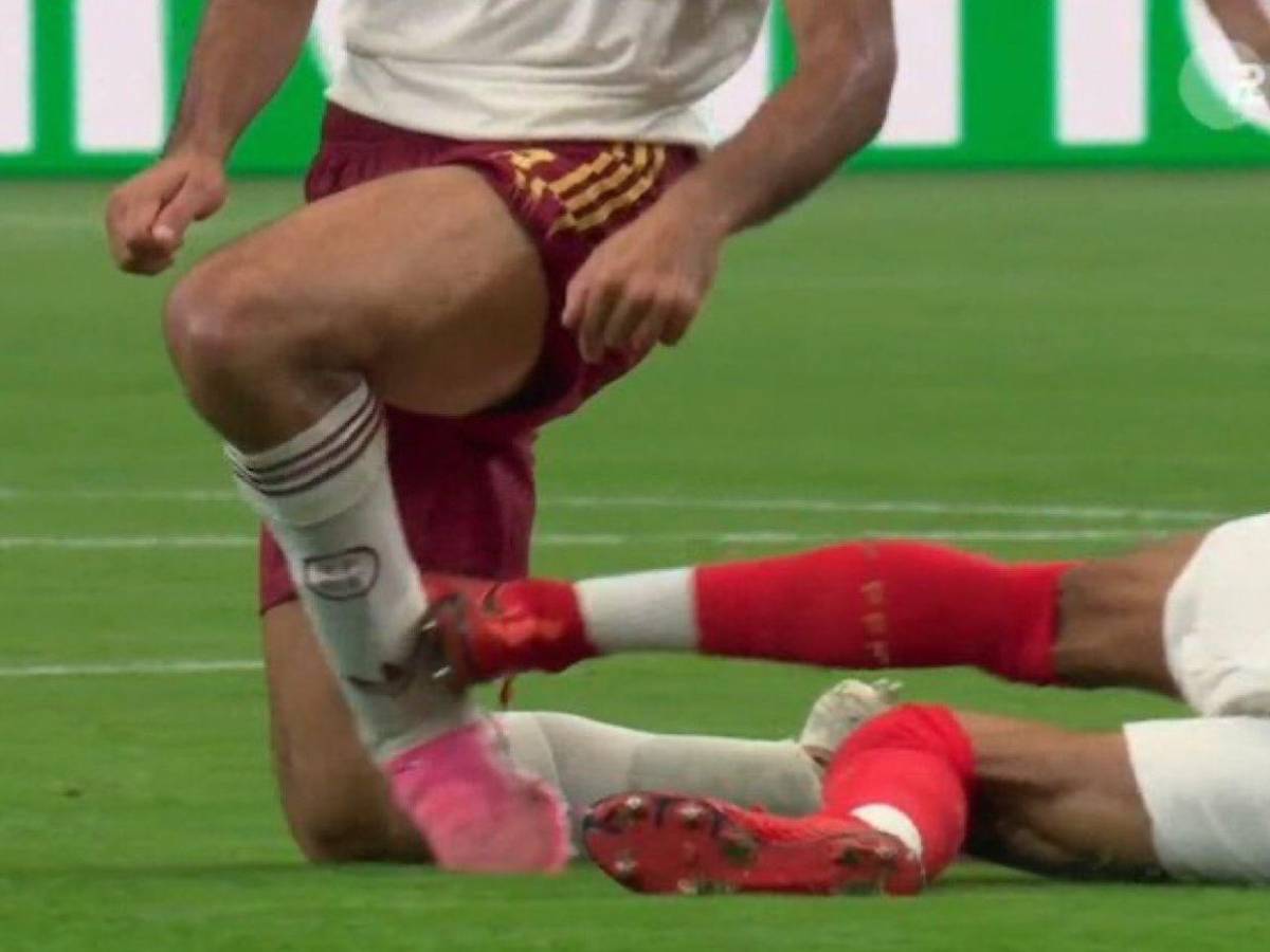 Didier Deschamps atiza contra salvadoreño Iván Barton; árbitro recibe varias críticas por su trabajo