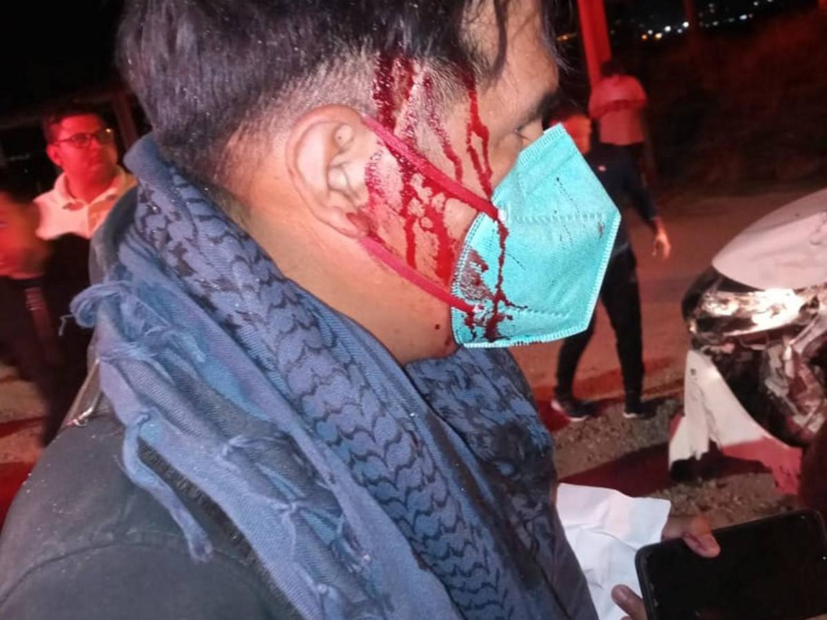 La tragedia que dejó a un policía muerto y varios heridos en La Paz