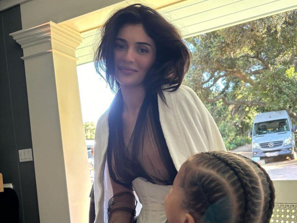 Kylie muestra su rostro natural tras disolver la mitad de su relleno de labios Kylie muestra su rostro natural tras disolver la mitad de su relleno de labios