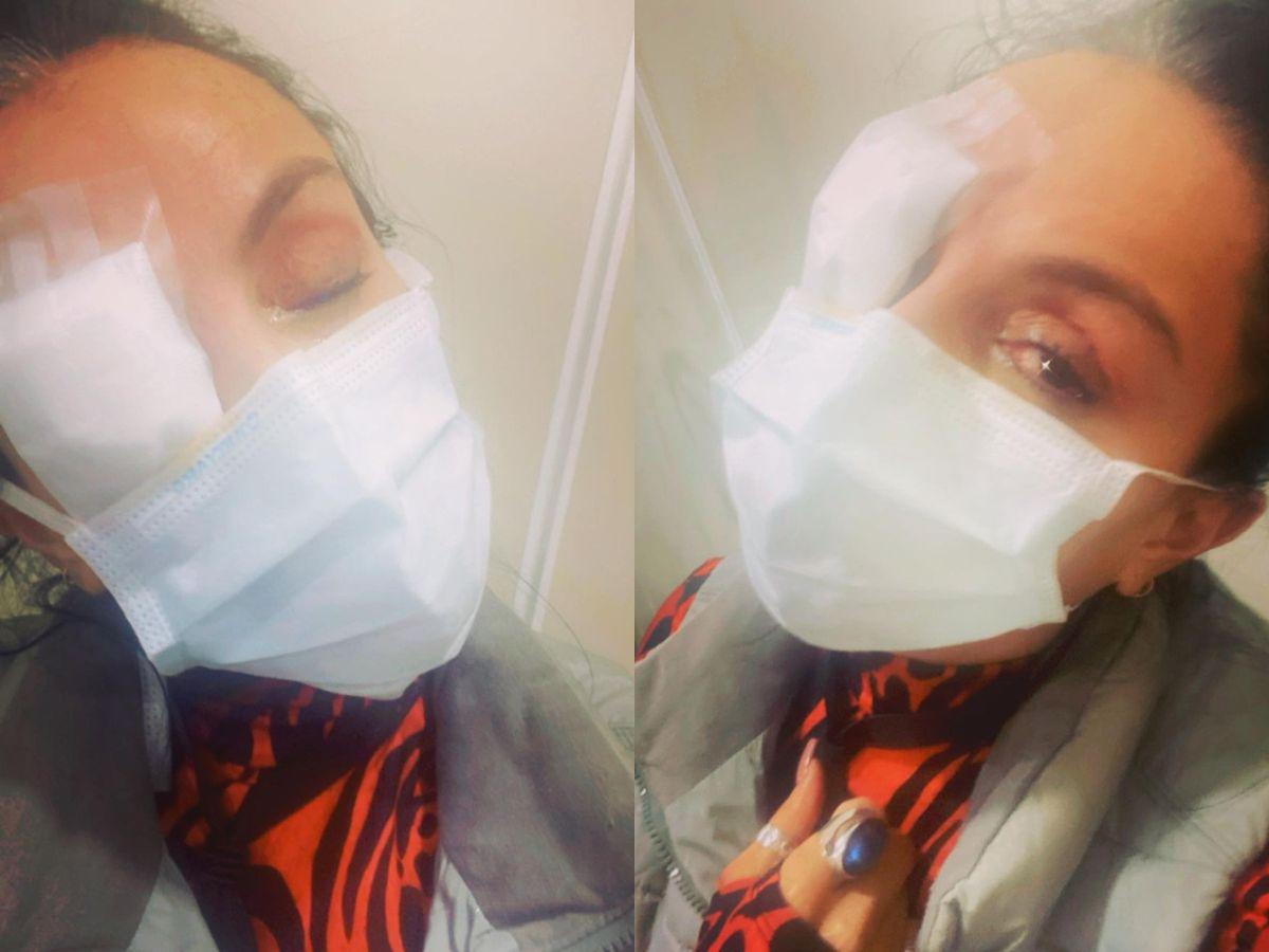 Ivonne Montero relata cómo se quemó las córneas por un descuido