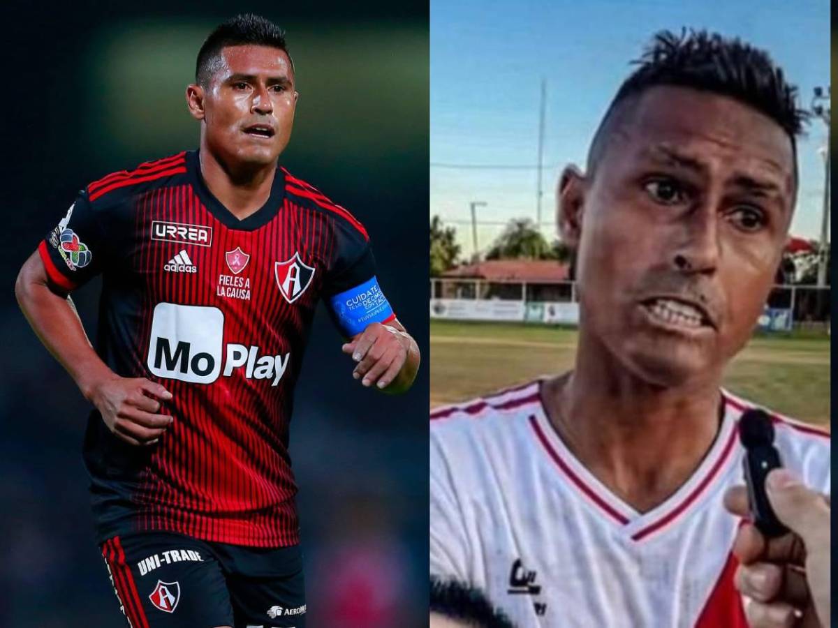 Osvaldo Martínez: ¿Qué enfermedad sufre y cuáles son sus consecuencias?