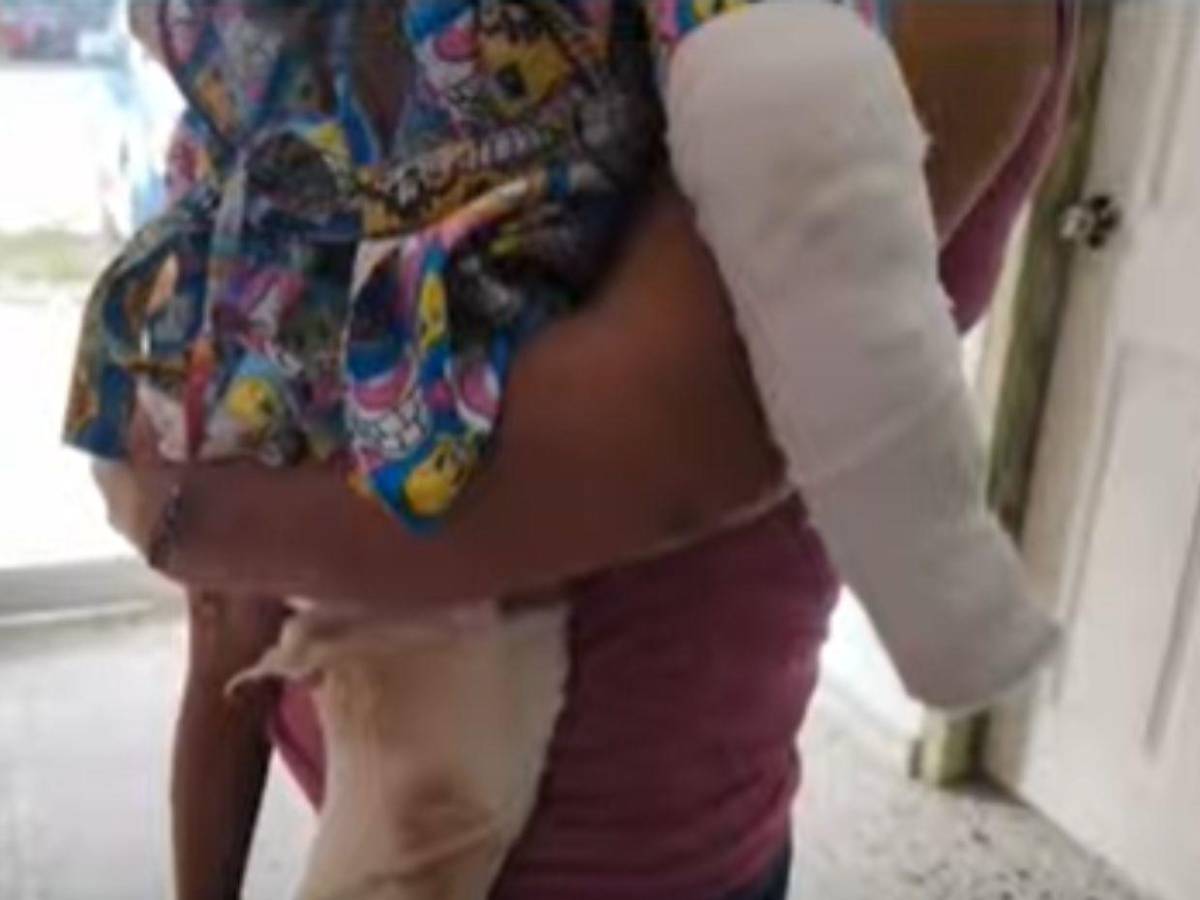 Él me lo quemó, por celos, denuncia madre de menor agredido por su pareja