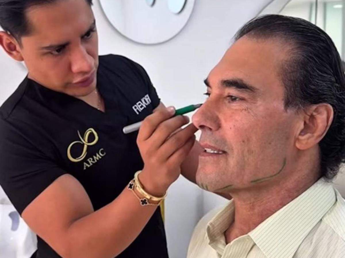 Así luce Eduardo Yáñez tras su procedimiento de rejuvenecimiento