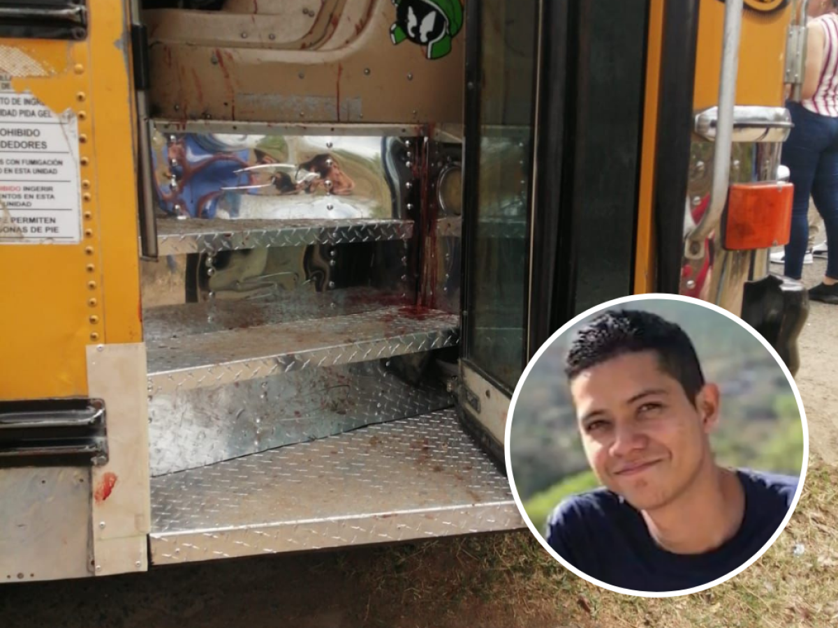 Muere una de las víctimas del atentado a bus de Lepaterique