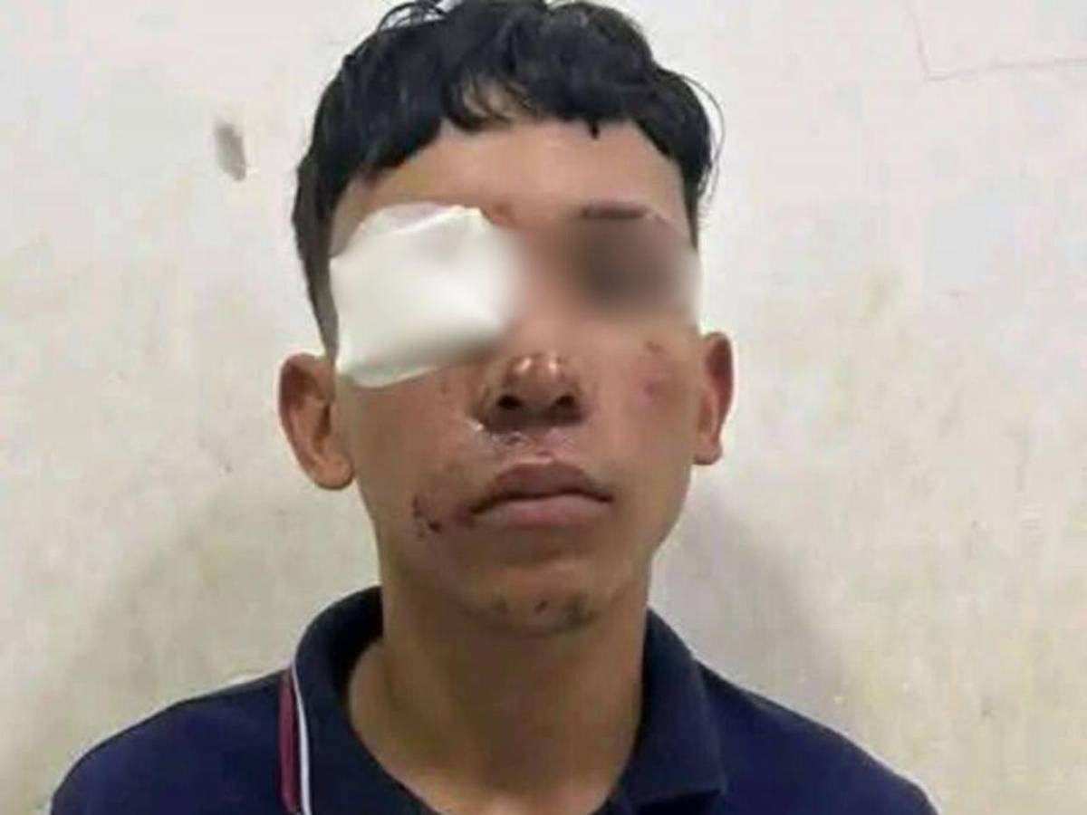 A una la degollaron y a la otra le dispararon: cronología del asesinato de dos hermanas en Colombia