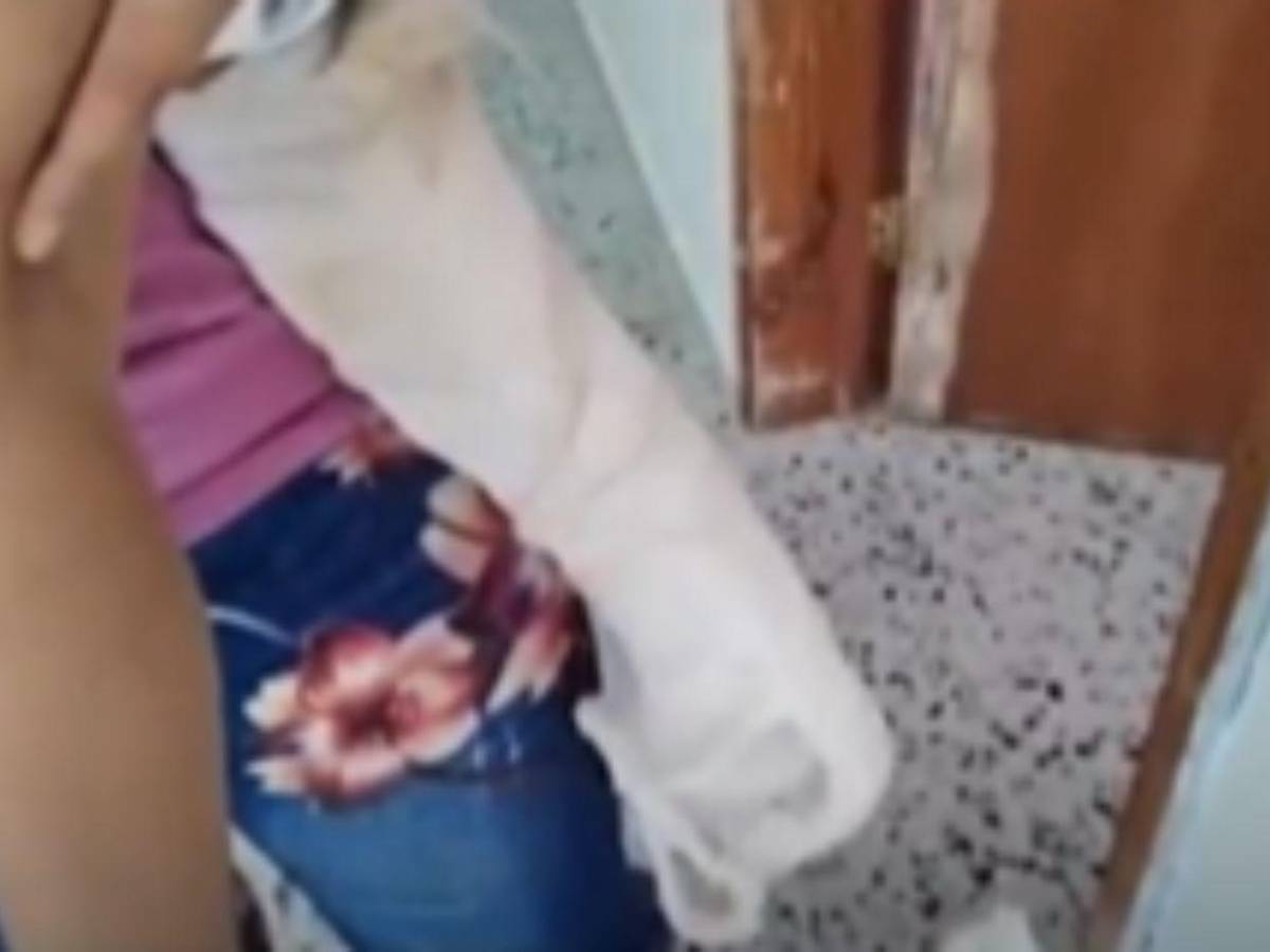 Él me lo quemó, por celos, denuncia madre de menor agredido por su pareja