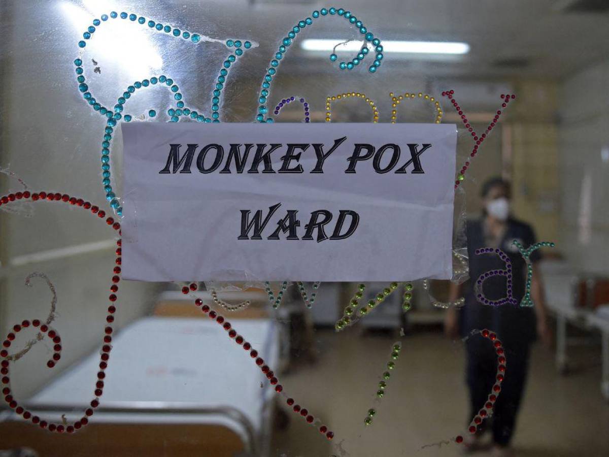 España reporta segunda muerte por viruela del mono