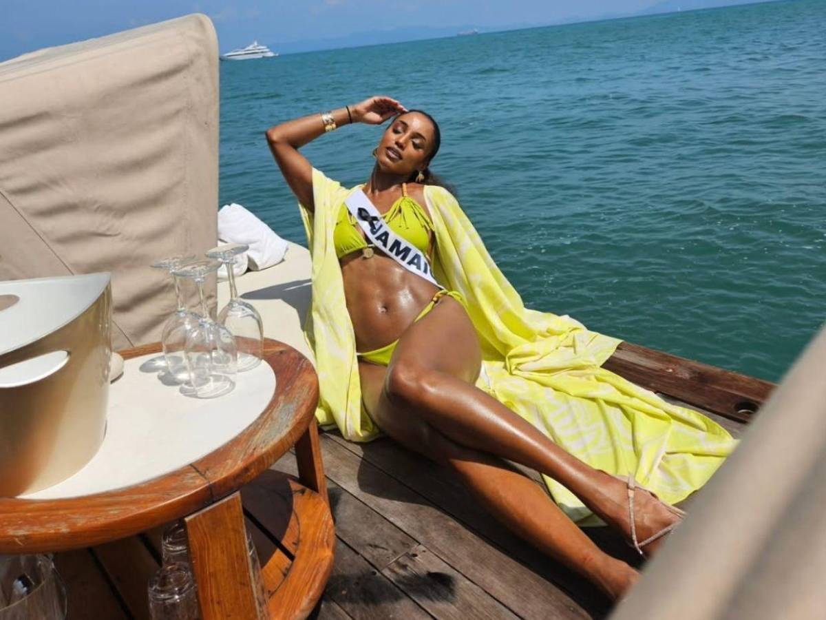 Fractura y hemorragia intracraneal: el diagnóstico de Miss Jamaica tras accidente