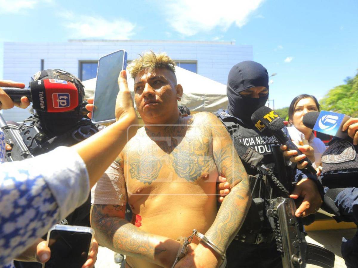 Supuesto líder de “La Kleivona” llega herido a la DPI y niega ser delincuente