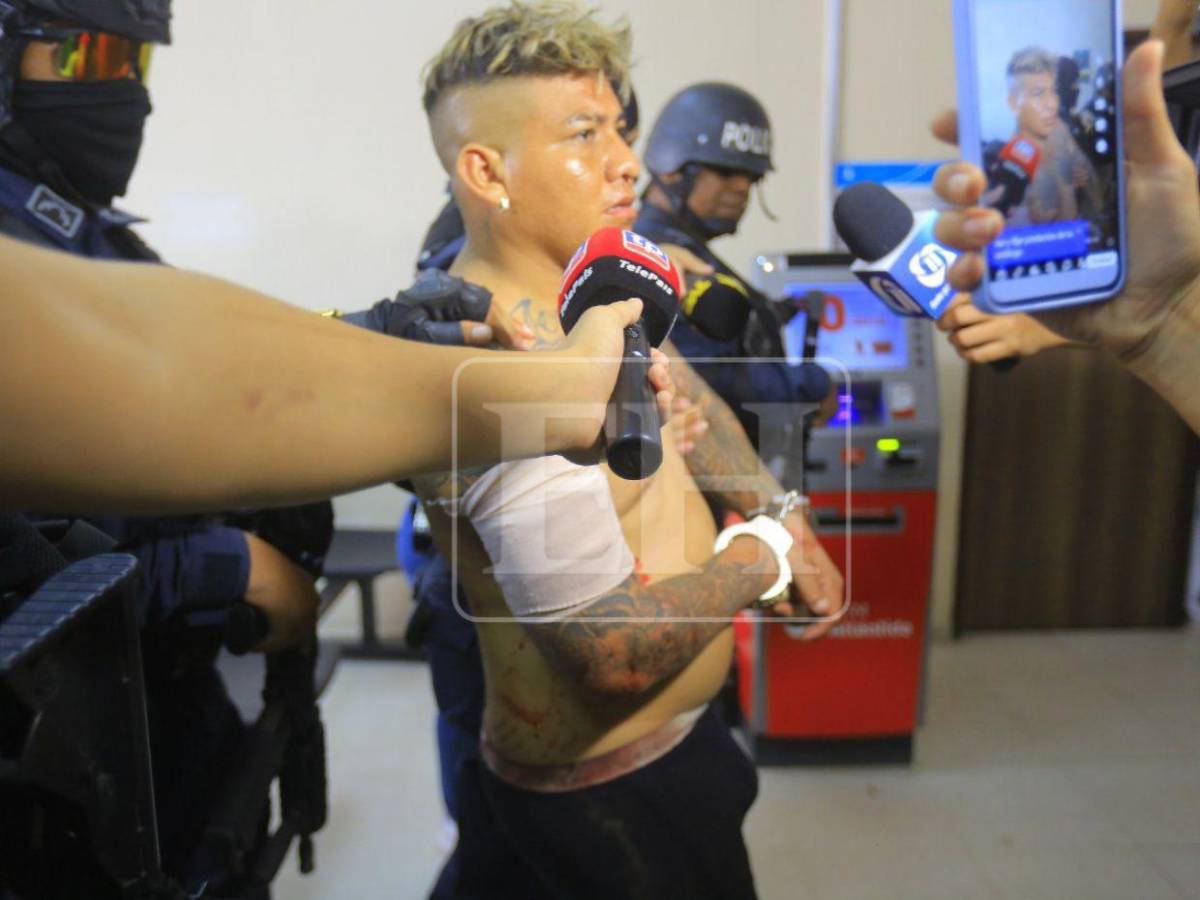 Supuesto líder de “La Kleivona” llega herido a la DPI y niega ser delincuente