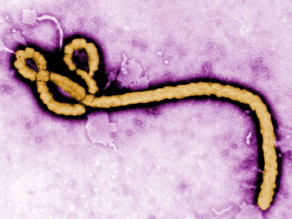 Ébola y sus síntomas: todo sobre la enfermedad que alerta a la OMS