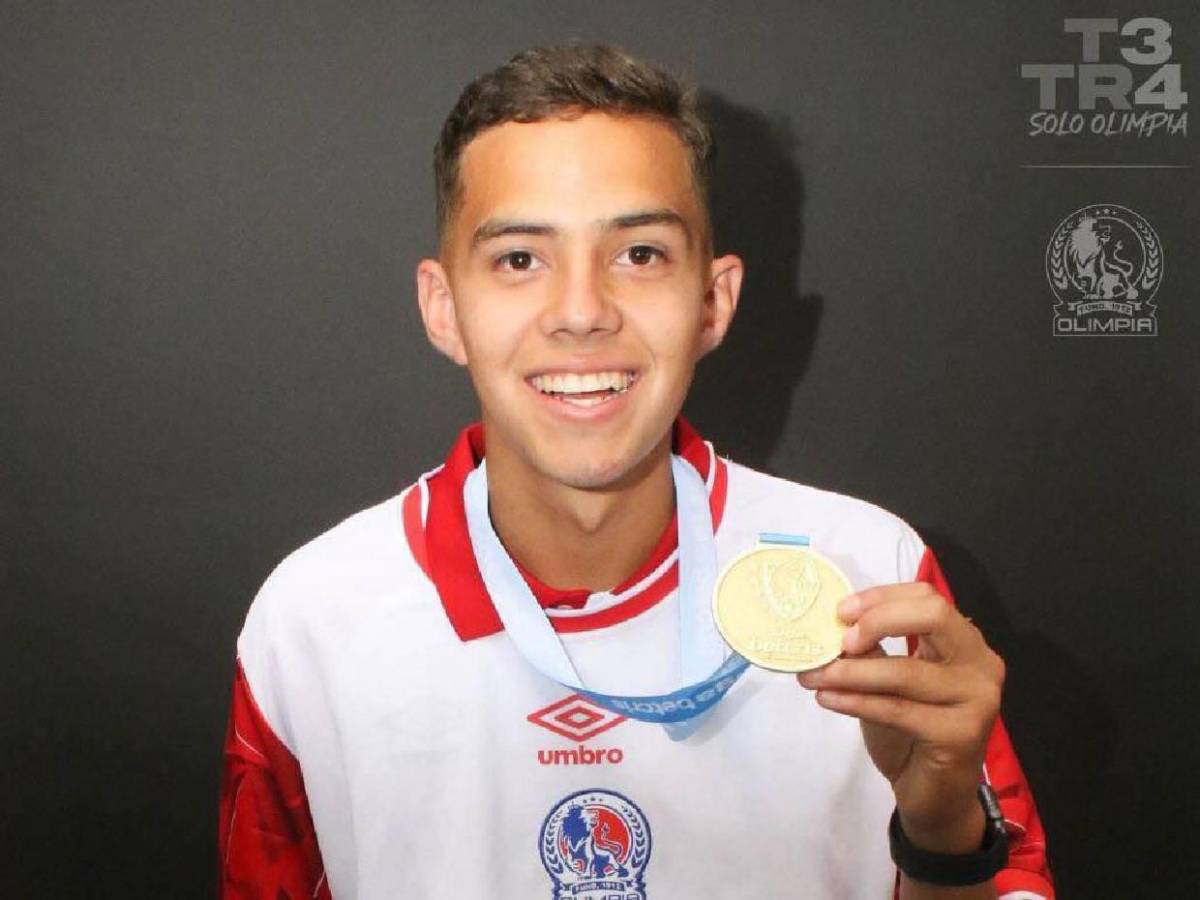 Los exjugadores de Olimpia que tenían un futuro prometedor y finalmente decepcionaron