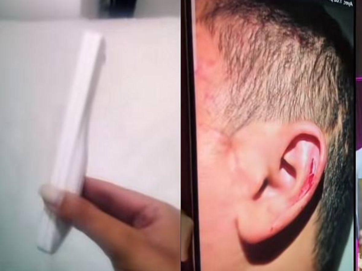 Encima de mí caía la sangre: Alejandra Rubio expone fotos de Javian Thompson agrediéndose por celos