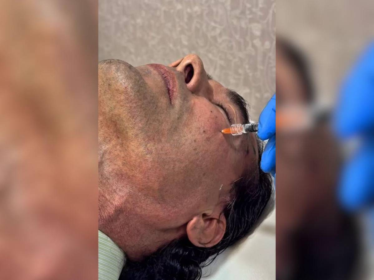 Así luce Eduardo Yáñez tras su procedimiento de rejuvenecimiento