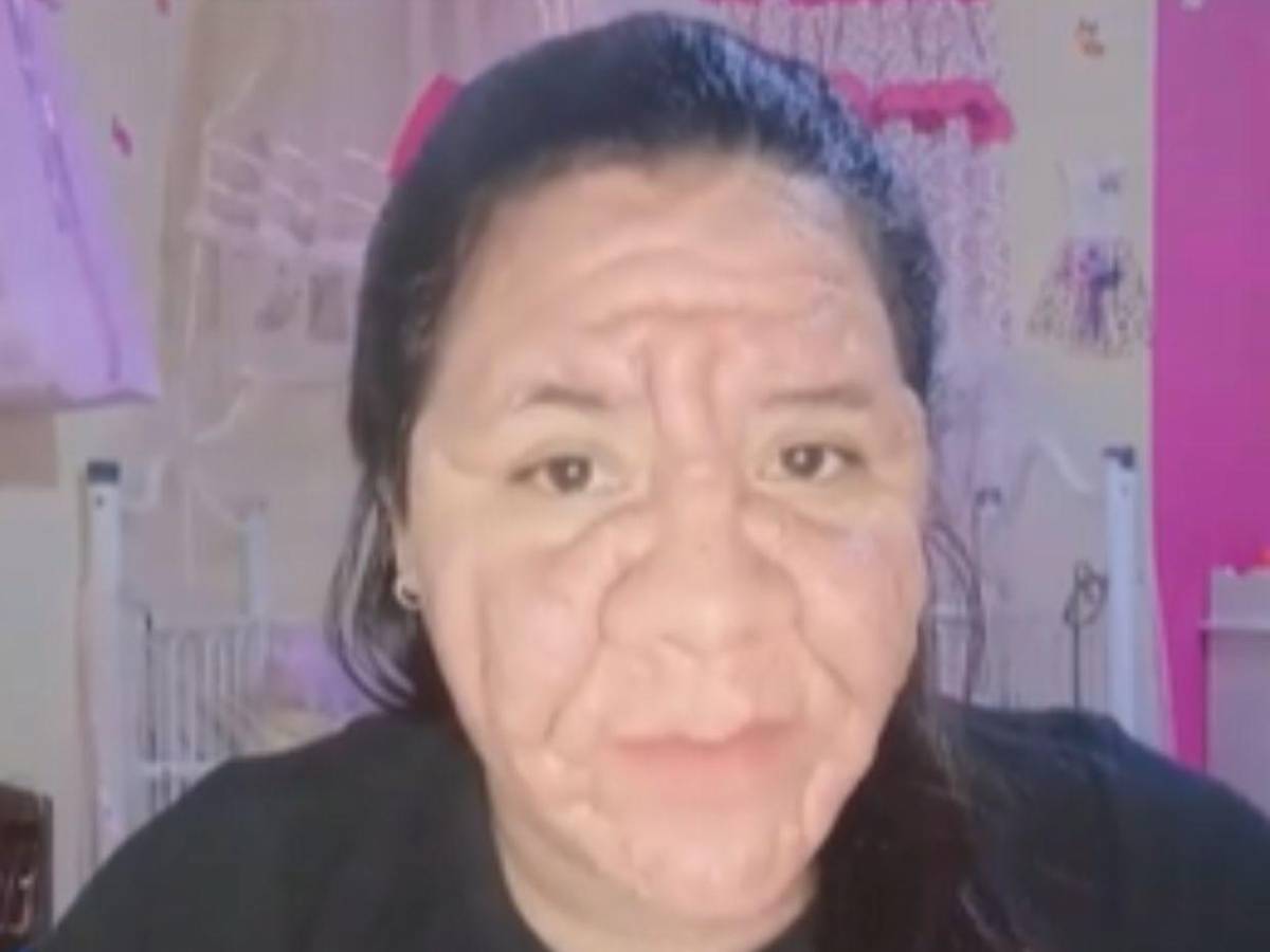 Joven con 8 meses de embarazo enfrenta deformación facial tras error médico