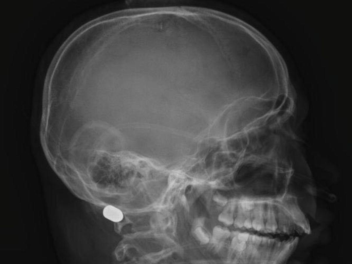 Emerson Villanueva, menor que habría muerto tras impacto de bala perdida en Lempira