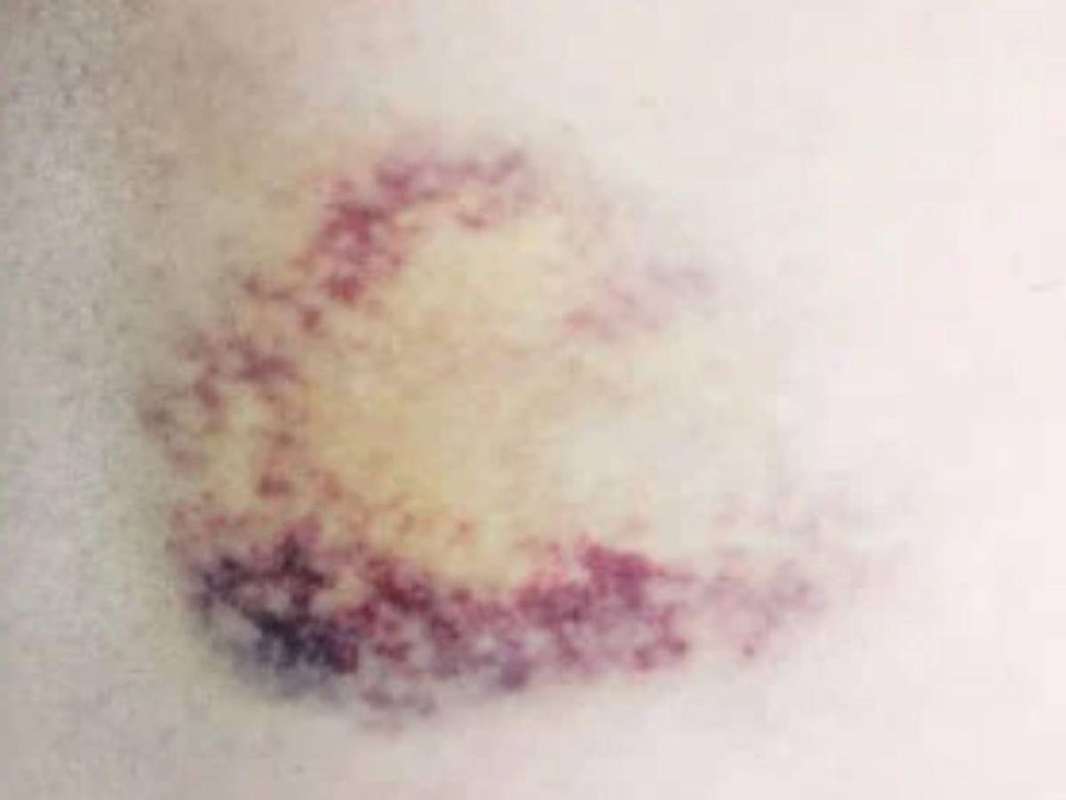 Natali Vázquez, menor de 9 años que murió tras presuntamente ser abusada en Choluteca