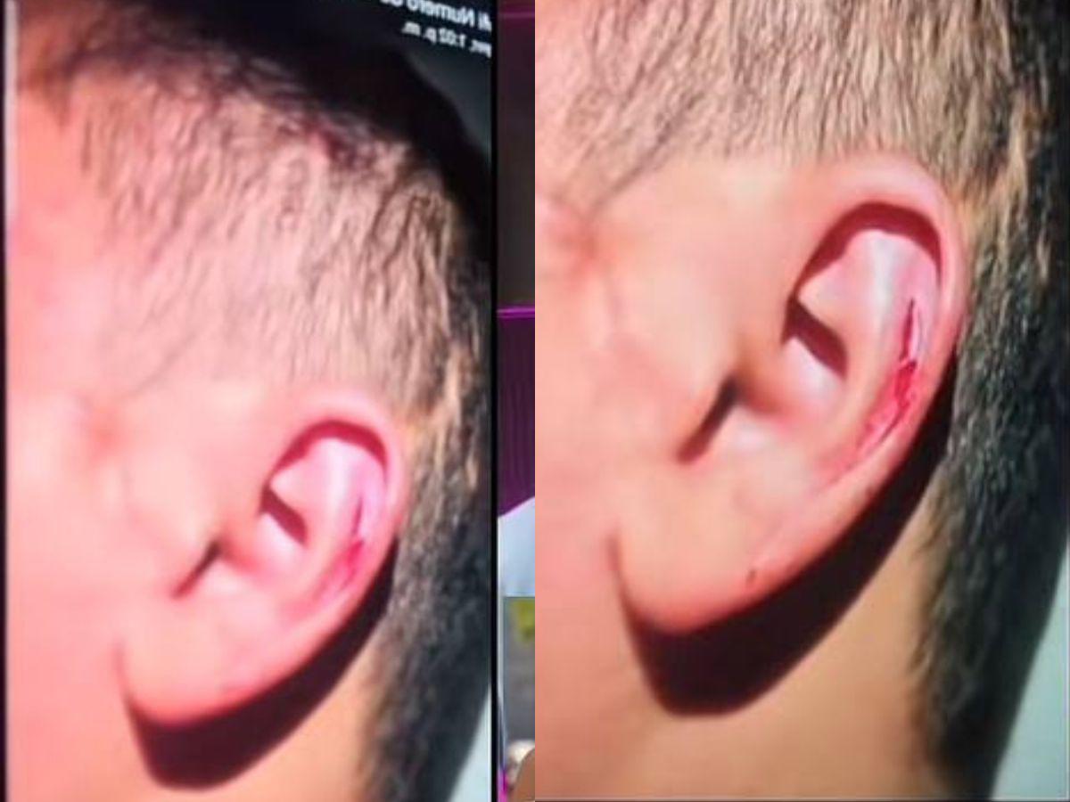 Encima de mí caía la sangre: Alejandra Rubio expone fotos de Javian Thompson agrediéndose por celos