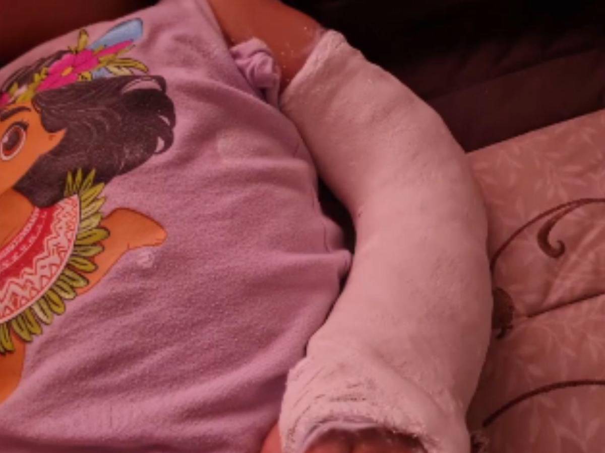 Ni radiografías, ni yesos: Francis Espinal denuncia impotente la falta de insumos en el IHSS