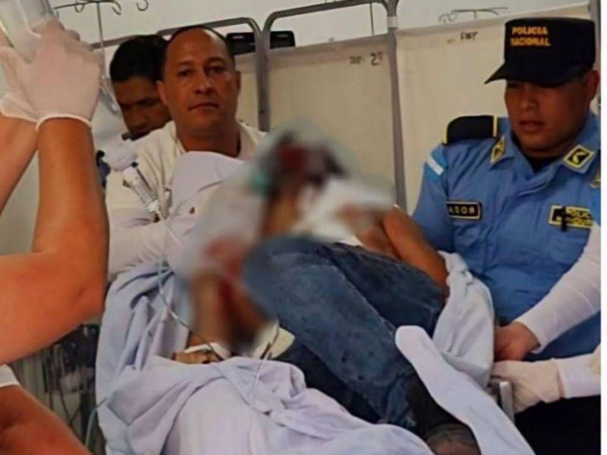Pidió auxilio tras recibir cuatro disparos: Anner Pastor, policía que murió tras asalto en autolote