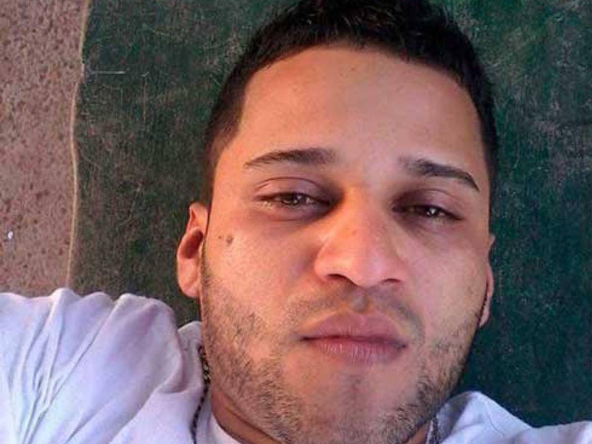 Golpes y mordidas: mujer fue salvajemente atacada por su pareja en Olancho