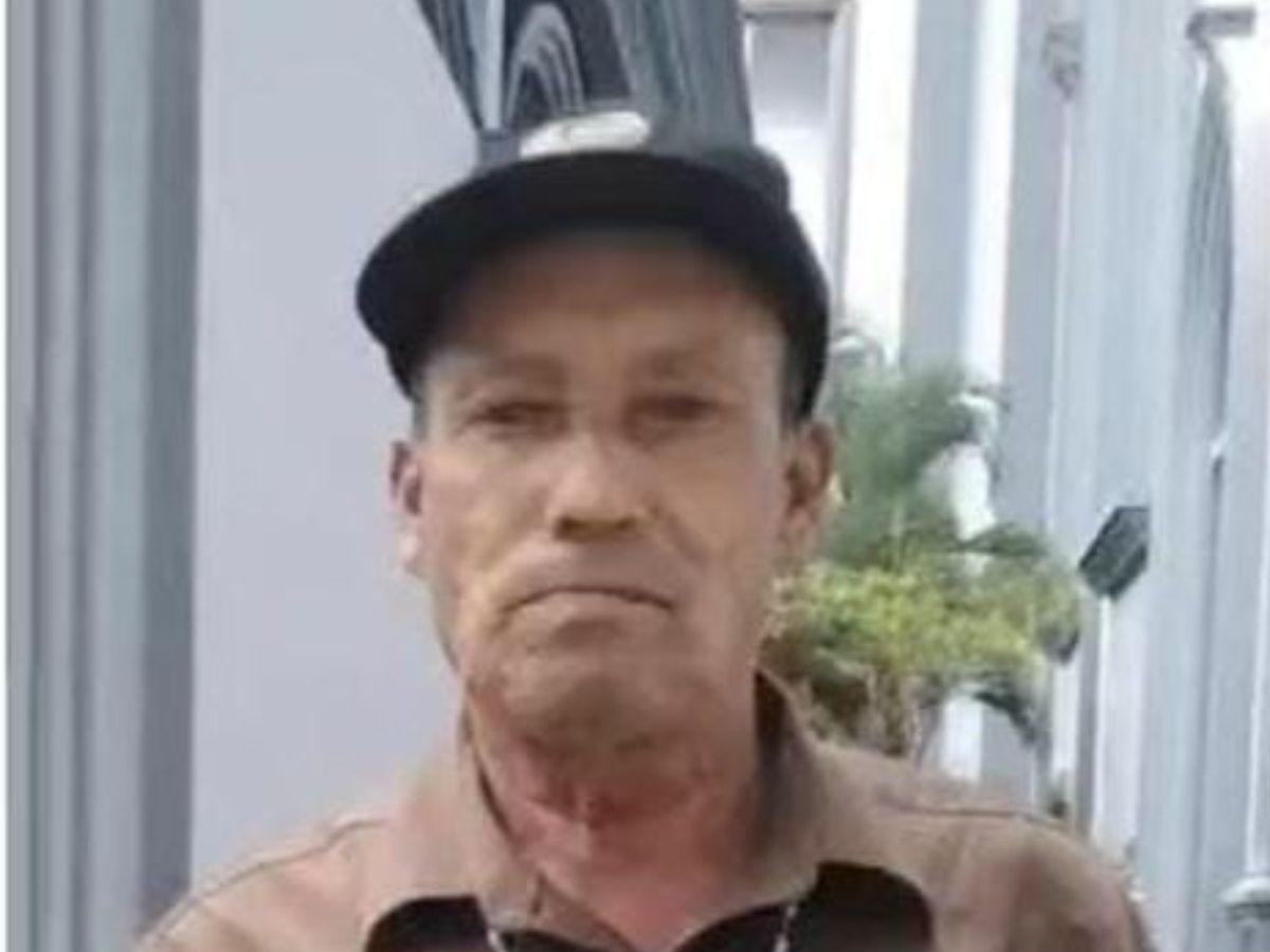 Estaba postrado en su cama y quedó atrapado en las llamas: Adalid Triminio falleció en El Paraíso