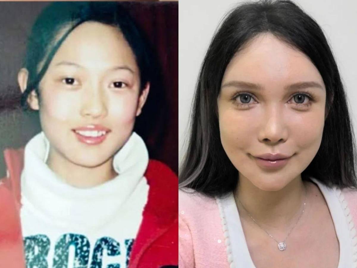 Abby Wu, la mujer que se ha hecho más de 100 cirugías: Nunca dejaré de hacérmelas