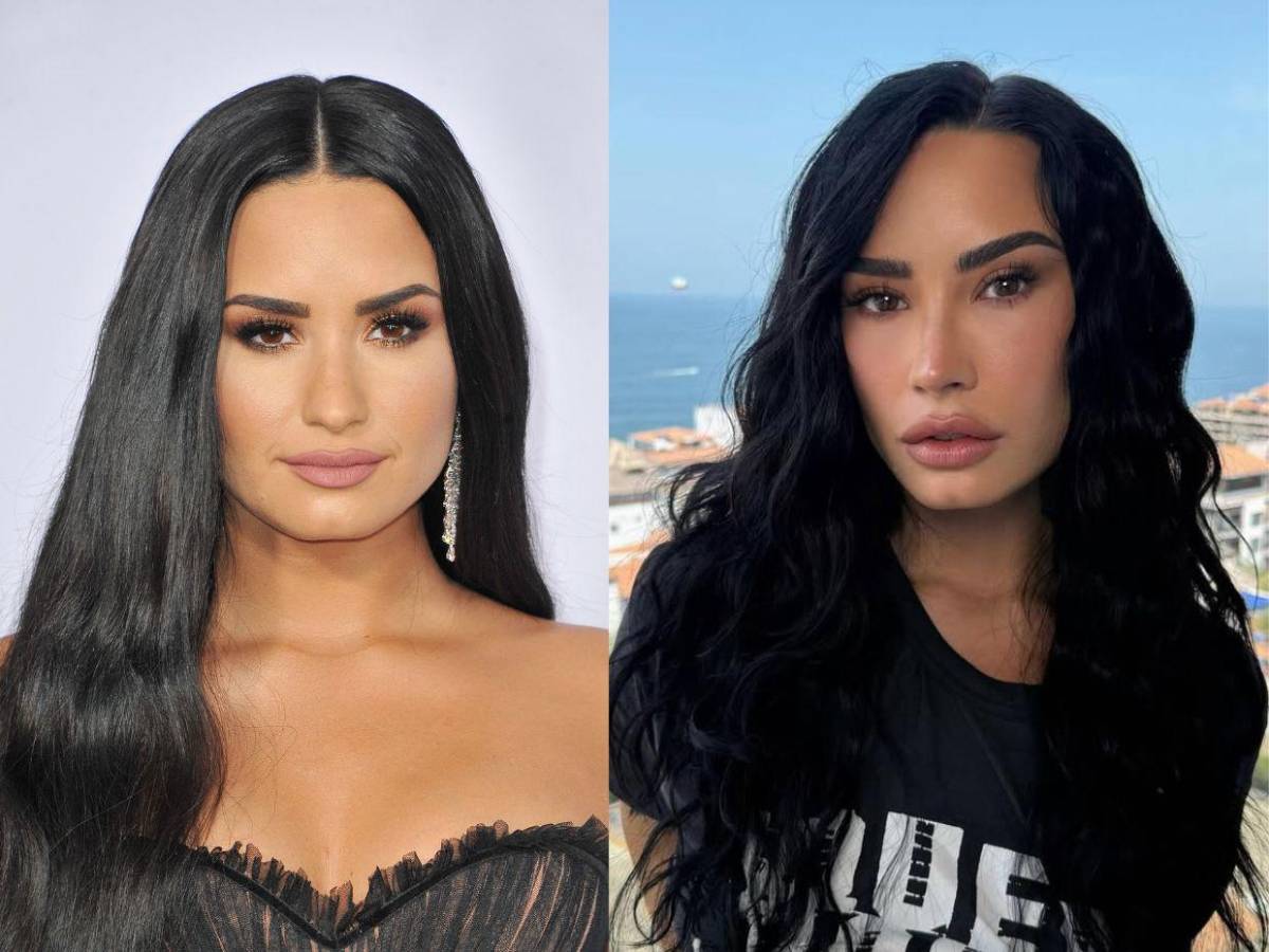El 'nuevo rostro' de Demi Lovato desata críticas y especulaciones en redes