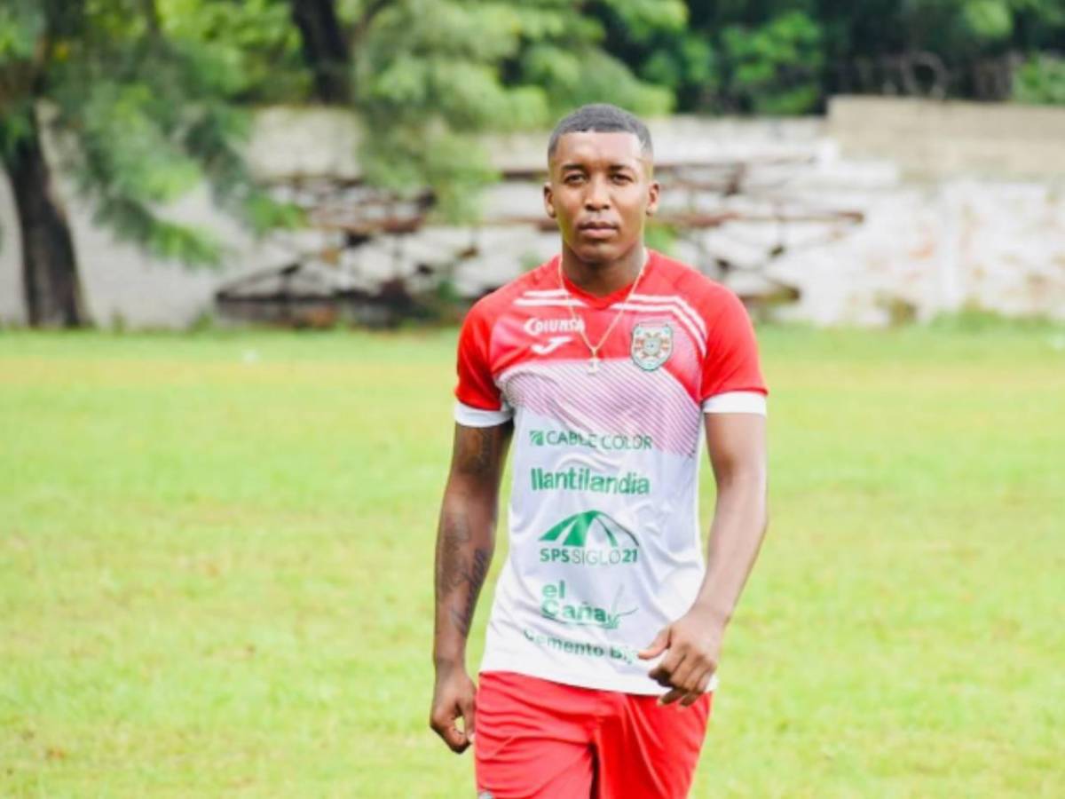 Futbolista hondureño fue tiroteado en SPS: Así vivió el momento que lo tuvo al borde de la muerte