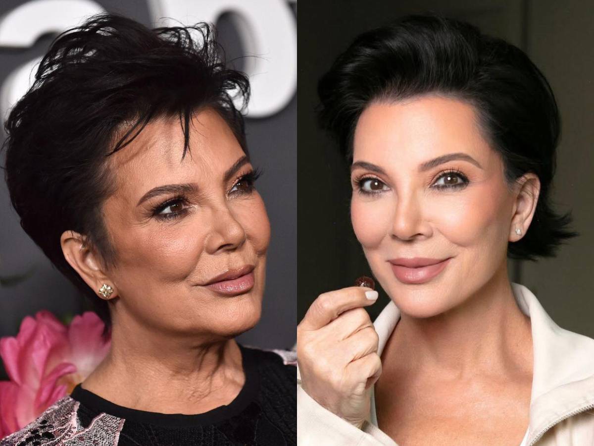 Transformación estética de Kris Jenner: ¿Cuánto costó?