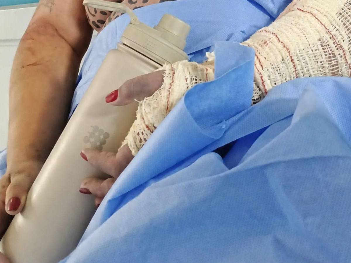 Periodista Jessiree Querales perdió un brazo y una pierna tras terremotos en Venezuela