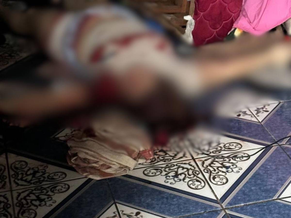 Le dispararon en la cabeza: ¿Qué se sabe del crimen de La Chelita en Corinto, Omoa?