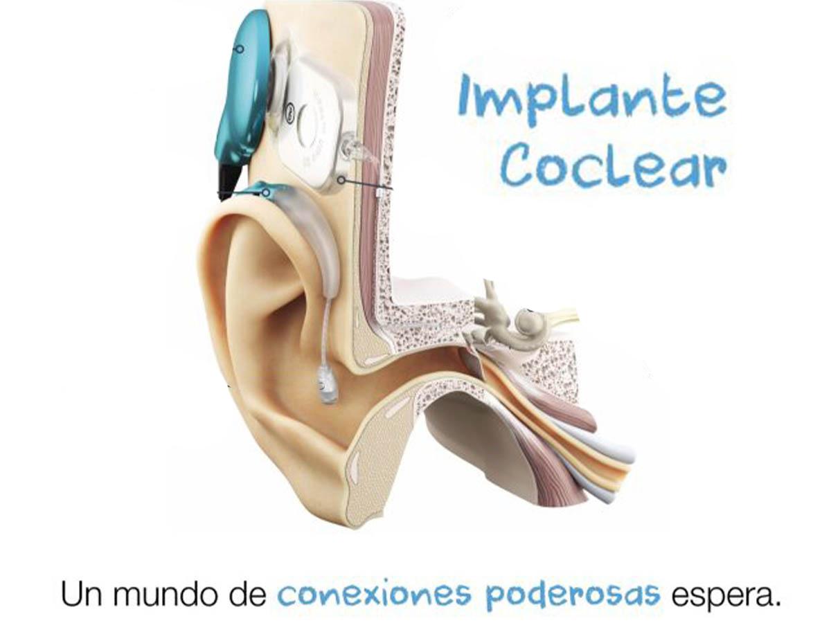 La detección temprana es clave. El Centro Audiológico Auris realiza tamizajes auditivos desde el nacimiento para una intervención oportuna en pacientes con pérdida auditiva.