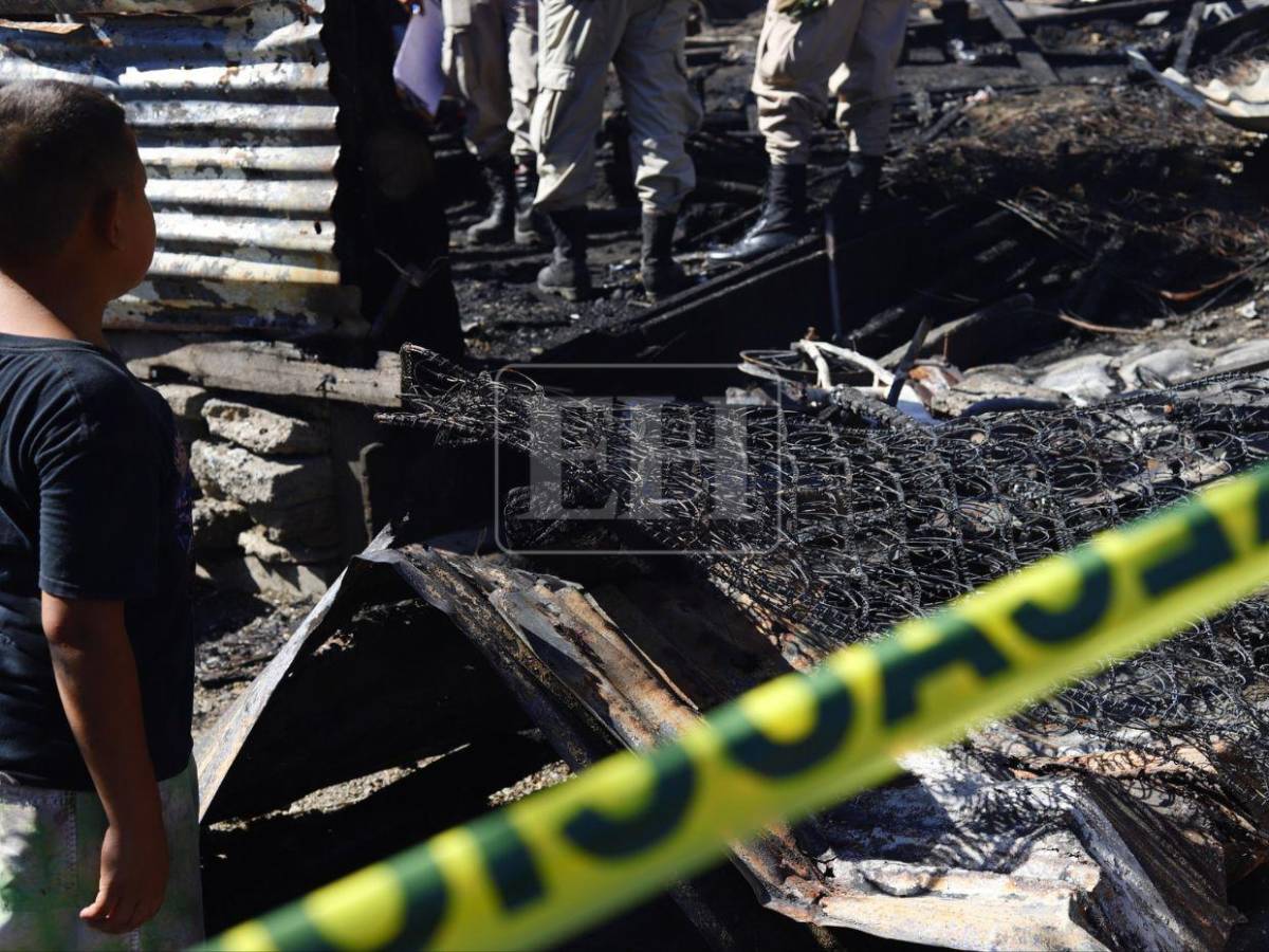 Dios ya lo había salvado: Niño fallecido en incendio en SPS había superado dos cirugías
