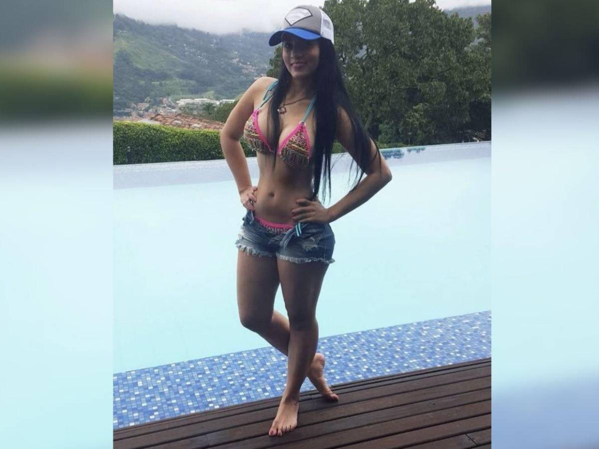 El antes y el después de la modelo Karina García: su transformación total