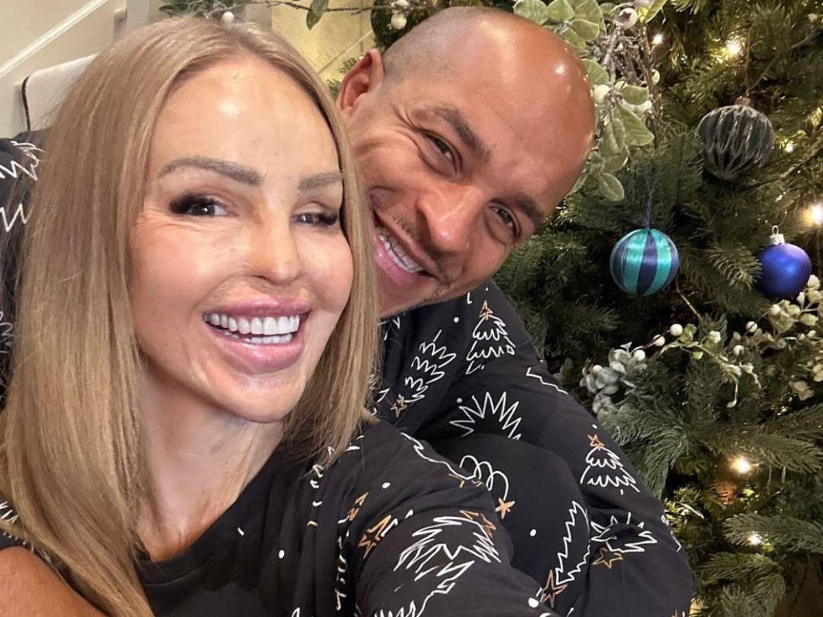 ¿Qué ha sido de Katie Piper, la presentadora a la que le tiraron ácido en la cara?