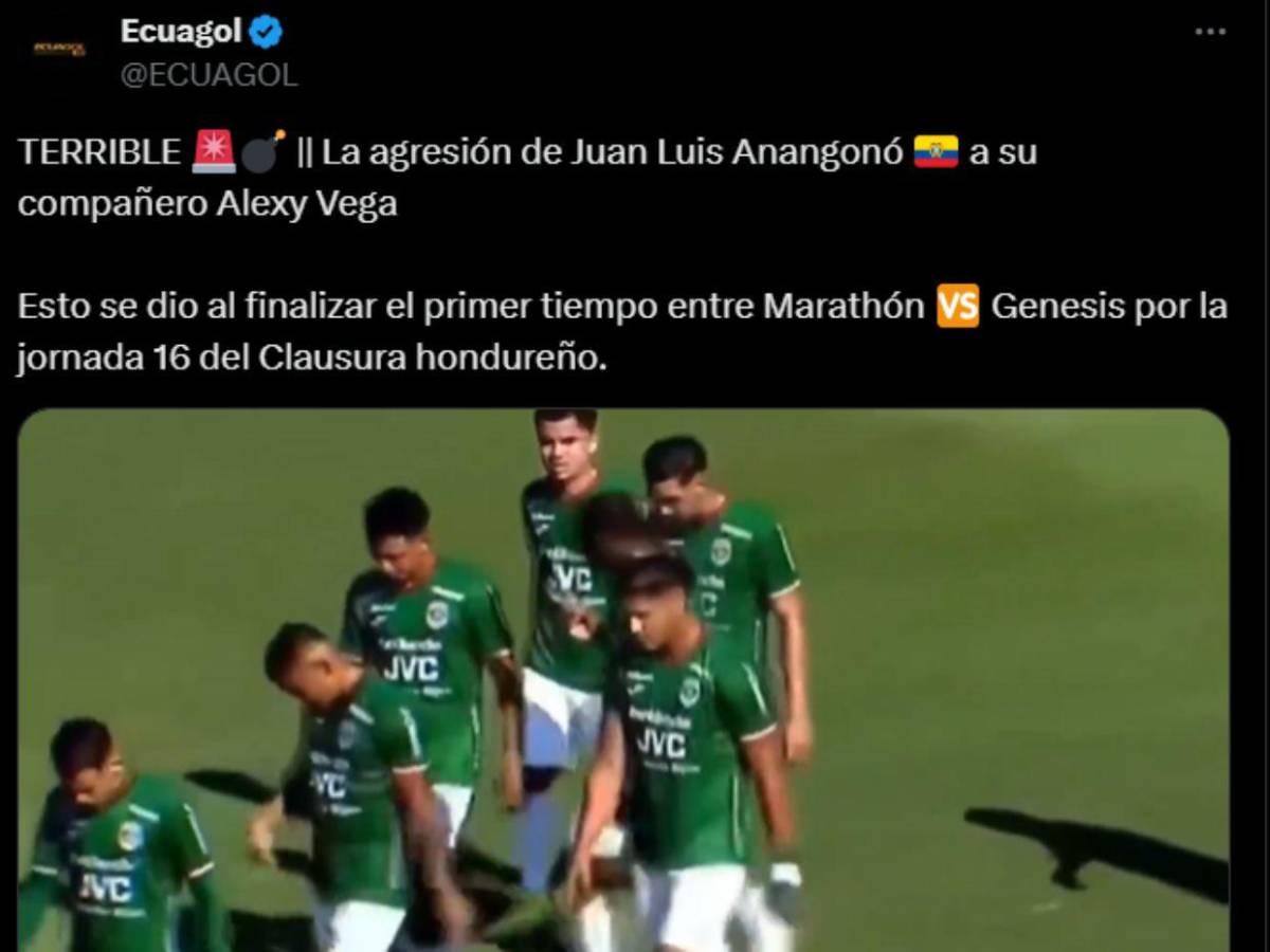 Vergonzoso: Lo que dice la prensa internacional ante la cachetada de Anangonó contra Alexy Vega Vergonzoso: Lo que dice la prensa internacional ante la cachetada de Anangonó contra Alexy Vega
