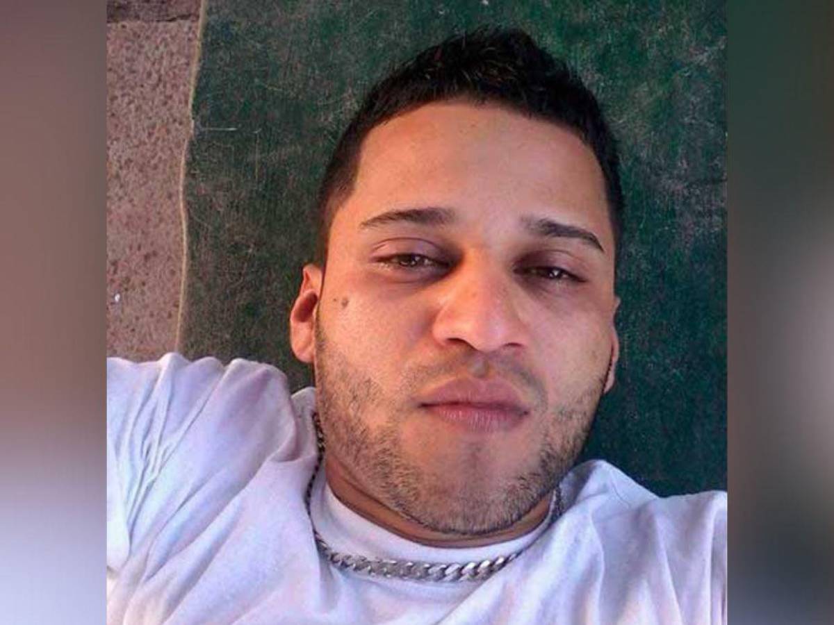 Golpes y mordidas: mujer fue salvajemente atacada por su pareja en Olancho