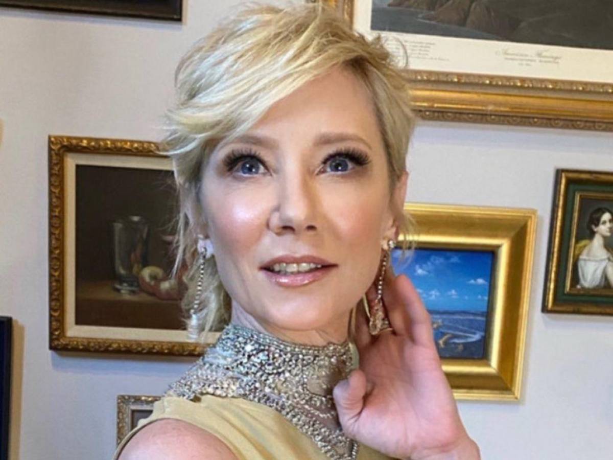 Actriz Anne Heche en estado crítico tras sufrir terrible accidente