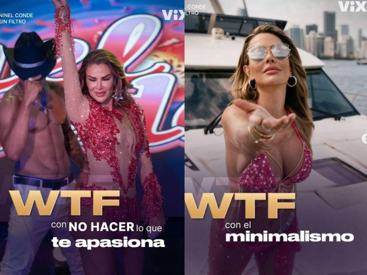 Sin filtro: Así habla Ninel Conde sobre la polémica de las cirugías