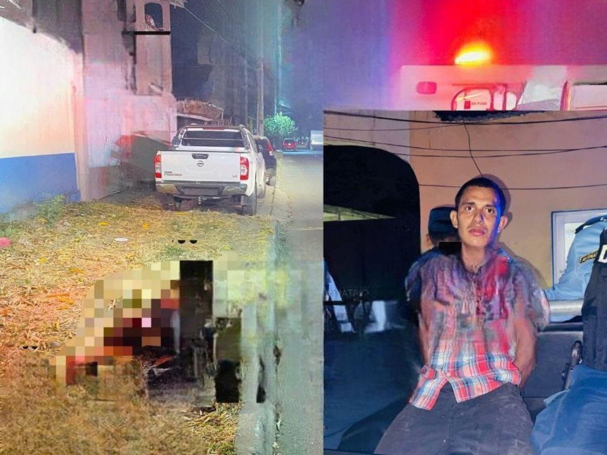 Recibió 30 machetazos: Yensy Guzmán quedó completamente desfigurada tras brutal ataque de su esposo
