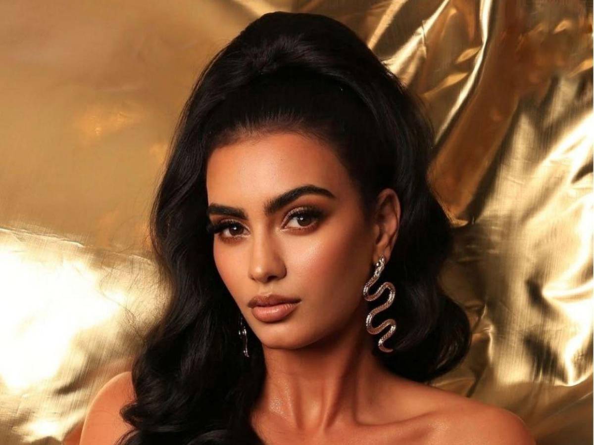 ¿Cuál es el estado de salud de Laura Pérez tras su caída en el Miss Universe Latina?