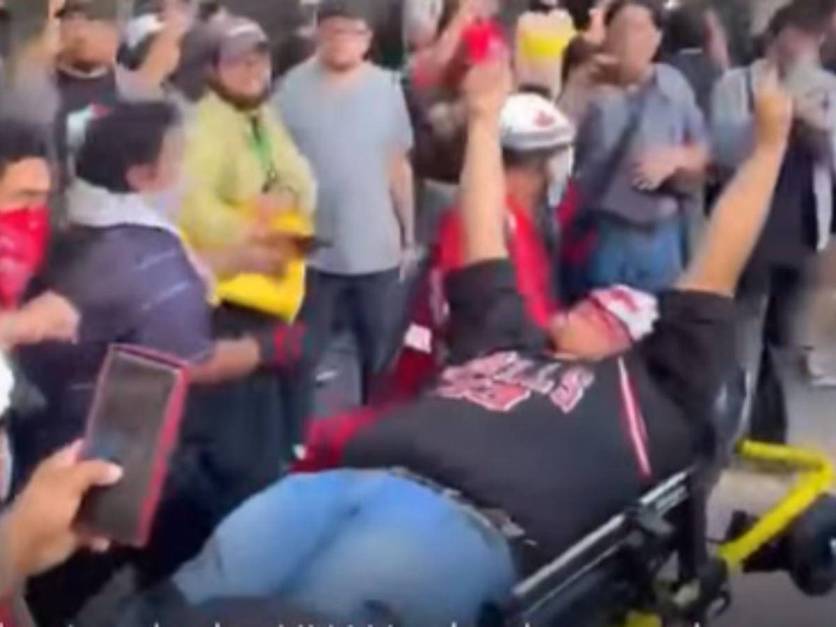 ¿Quién es el estudiante de la UNAH que perdió un ojo durante protesta en el Congreso?