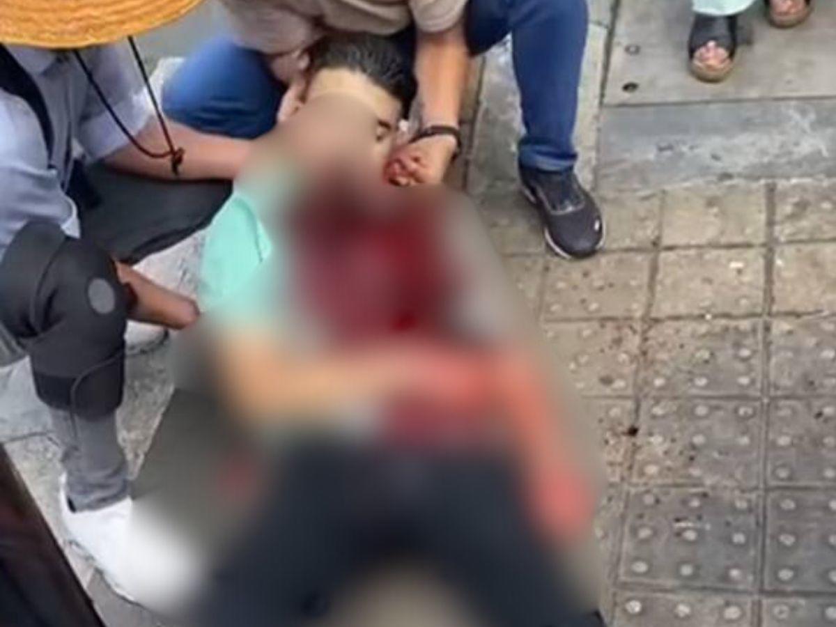 Se negó a darle una moneda y recibió una herida en el cuello: indigente asesinó a un joven en Colombia