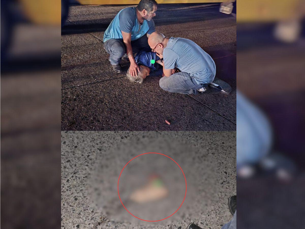 Adulta mayor pierde un pie tras ser atropellada por motociclista que huyó en Choloma, Cortés