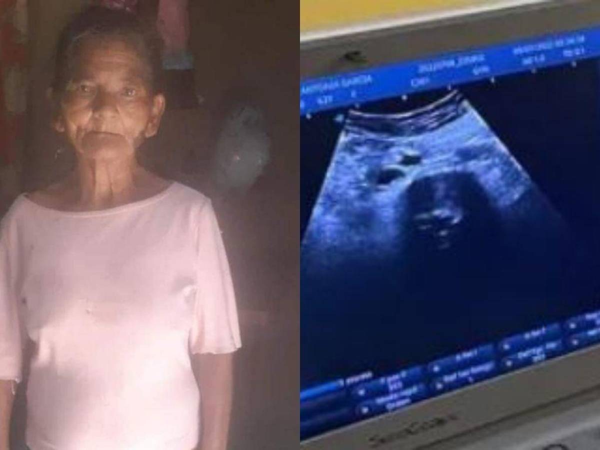 Descartan embarazo en abuelita de Comayagua